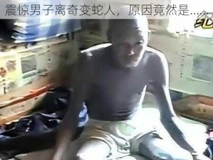 震惊男子离奇变蛇人，原因竟然是……