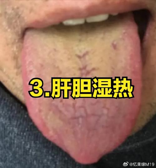 14MAY18_XXXXXL 放屁舒缓压力助眠好物，享受舒适睡眠