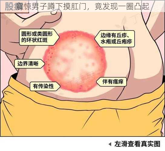 震惊男子蹲下摸肛门，竟发现一圈凸起