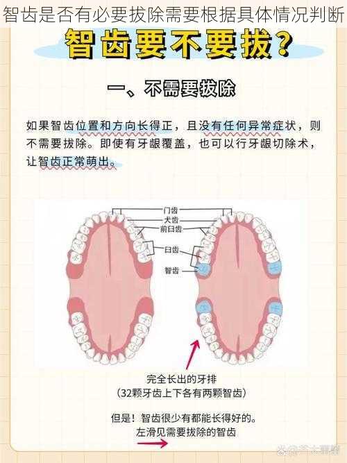 智齿是否有必要拔除需要根据具体情况判断