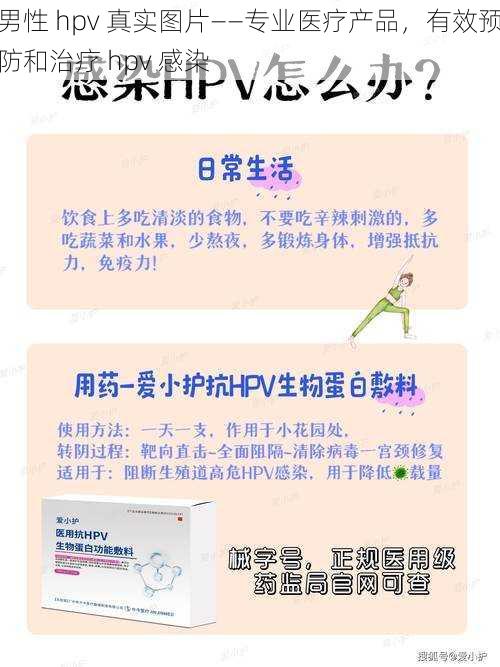 男性 hpv 真实图片——专业医疗产品，有效预防和治疗 hpv 感染